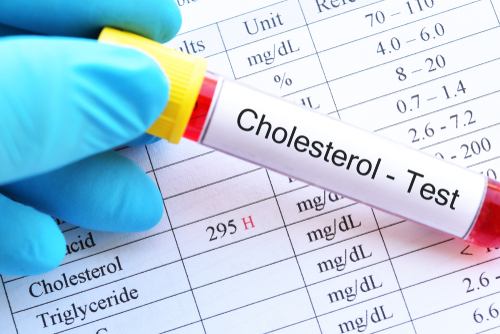 Cholestérol : vous allez enfin y comprendre quelque chose